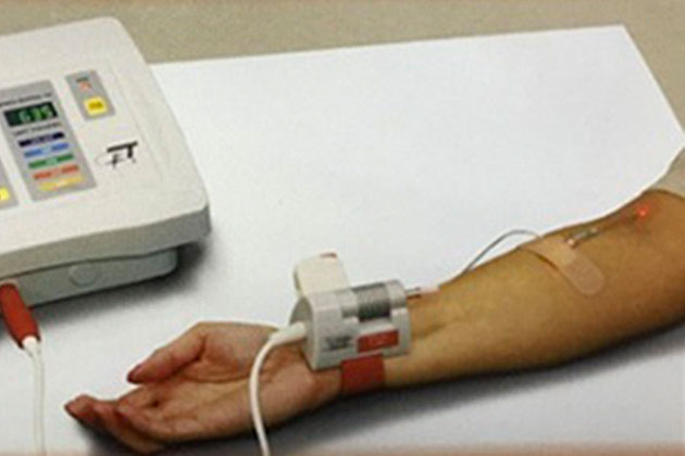 ВЛОК внутривенное лазерное облучение крови